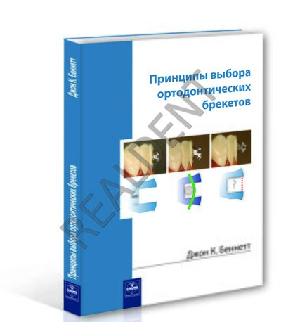 Принципы выбора ортодонтических брекетов
